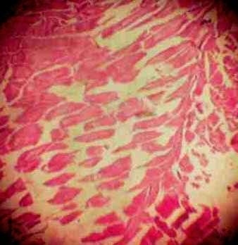 Effect of Source and Level of Dietary Water Hyacinth on Nile Tilapia Oreochromis Niloticus- Histopathology - Image 32