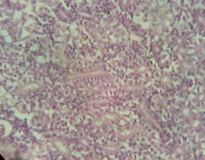 Effect of Source and Level of Dietary Water Hyacinth on Nile Tilapia Oreochromis Niloticus- Histopathology - Image 15