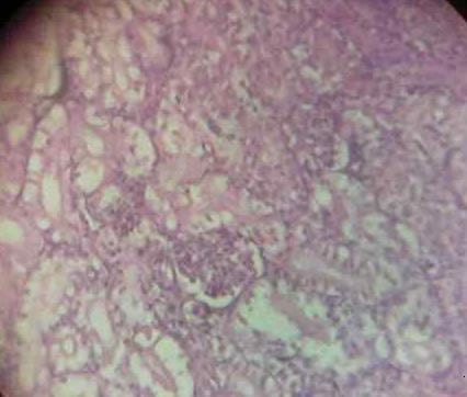 Effect of Source and Level of Dietary Water Hyacinth on Nile Tilapia Oreochromis Niloticus- Histopathology - Image 14