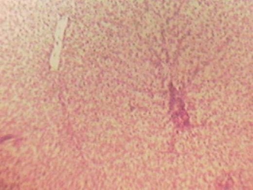 Effect of Source and Level of Dietary Water Hyacinth on Nile Tilapia Oreochromis Niloticus- Histopathology - Image 6