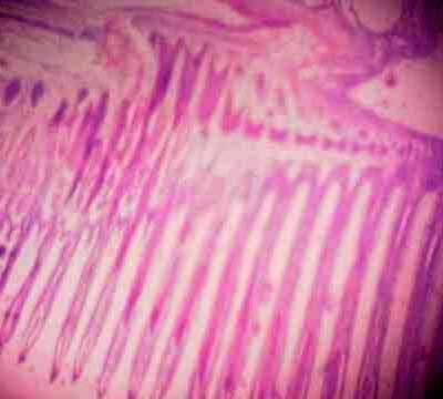 Effect of Source and Level of Dietary Water Hyacinth on Nile Tilapia Oreochromis Niloticus- Histopathology - Image 27