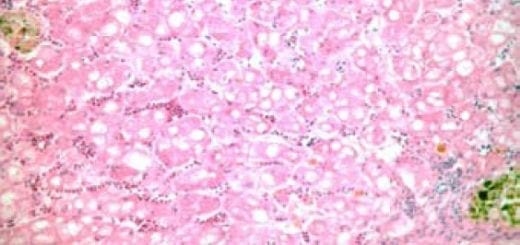 The Safety and Efficacy of a Streptococcus iniae Vaccine in Asian Sea Bass - Image 4