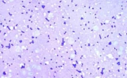 Important Diseases of Farmed Barramundi in Asia - Image 16