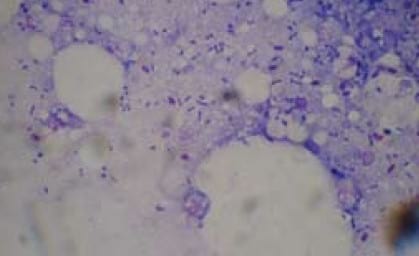 Important Diseases of Farmed Barramundi in Asia - Image 6