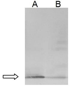 Use of egg yolk antibodies in the neutralization of shiga toxin - Image 1