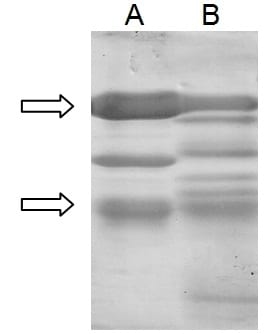 Use of egg yolk antibodies in the neutralization of shiga toxin - Image 2