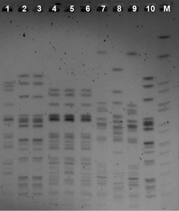 Incubator room dissemination of escherichia coli clones: isolation from bone marrow and resistance to gentamicin - Image 2
