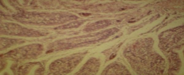 Diagnosis of salpingitis in female broilers with mycotoxicosis - Image 3