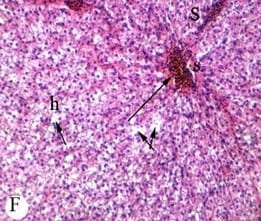Protective effect of antioxidant medicinal herbs, Rosemary and Parsley, on subacute aflatoxicosis in Oreochromis niloticus - Image 8