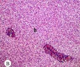 Protective effect of antioxidant medicinal herbs, Rosemary and Parsley, on subacute aflatoxicosis in Oreochromis niloticus - Image 4