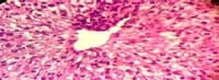 Nutritious Attempts to Detoxify Aflatoxic Diets of Tilapia Fish - Image 11