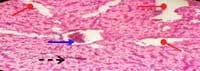 Nutritious Attempts to Detoxify Aflatoxic Diets of Tilapia Fish - Image 15