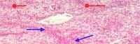 Nutritious Attempts to Detoxify Aflatoxic Diets of Tilapia Fish - Image 21