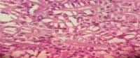 Nutritious Attempts to Detoxify Aflatoxic Diets of Tilapia Fish - Image 25