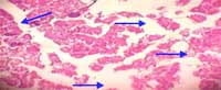 Nutritious Attempts to Detoxify Aflatoxic Diets of Tilapia Fish - Image 33