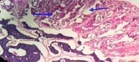 Nutritious Attempts to Detoxify Aflatoxic Diets of Tilapia Fish - Image 65