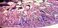 Nutritious Attempts to Detoxify Aflatoxic Diets of Tilapia Fish - Image 67