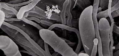 Interpretation of the results of mycotoxin's analysis in feed - Image 2
