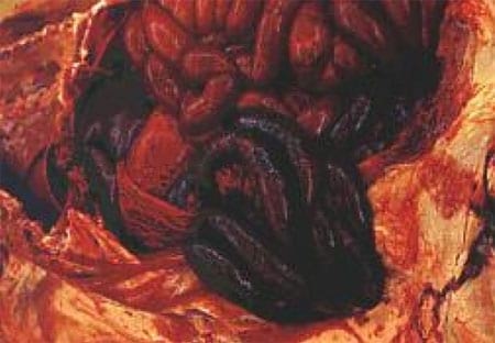 Porcine Intestinal Adenomatosus (Pig Ileitis) - Image 4