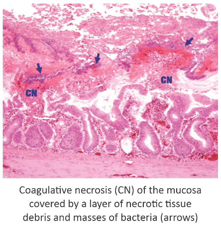 Challenging Re-emergence of Necrotic Enteritis in Poultry - Image 2