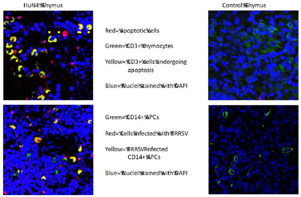 TOP: CD3+ thymocytes infected with PRRSV undergo apoptosis. BOTTOM: CD14+ APCs in piglets infected with HuN4 PRRSV, are infected with PRRSV. 
