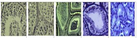 Aromatase immunolocalization in male goat reproduction tract and accessory glands - Image 2