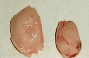 Evaluation of Size and Lesion Scores of Bursa Cloacae in Broiler Flocks in Algeria - Image 5