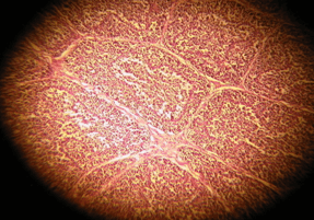 Evaluation of Size and Lesion Scores of Bursa Cloacae in Broiler Flocks in Algeria - Image 6