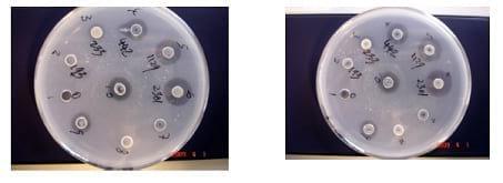 Interactions of phytate and myo-inositol phosphate esters (IP1-5) including IP5 isomers with dietary protein and iron and inhibition of pepsin - Image 10