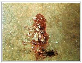 Swine Dysentery Too Costly to Live With - Image 3
