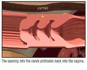A.I. Technique in Cattle - Image 2