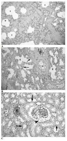Hemorrhagic Septicemia in Buffalo (Bubalus bubalis) Calves Under Sub-Tropical Conditions in Pakistan - Image 5