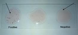 Development of Slide Micro-agglutination System for the Rapid Diagnosis of Salmonella Infection in the Chicken - Image 2
