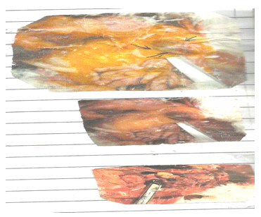 Newcastle Disease Viruses - Image 16