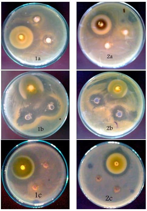 An In Vitro Study on the Effect of some Pre and Probiotics on some pathogenic Bacteria - Image 10