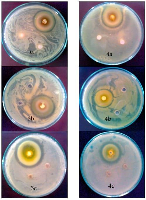 An In Vitro Study on the Effect of some Pre and Probiotics on some pathogenic Bacteria - Image 11