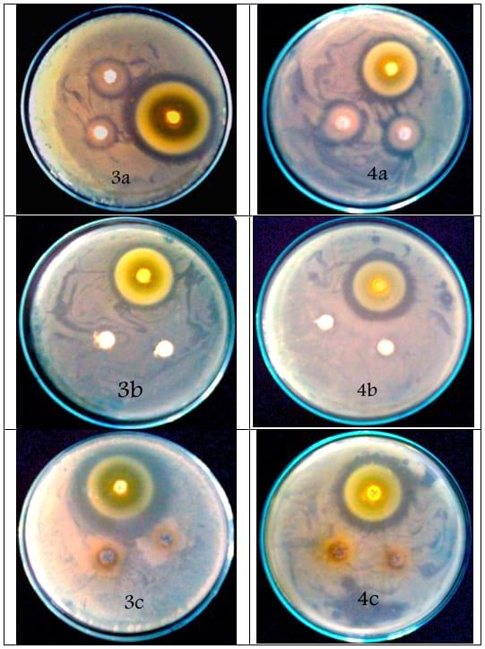 An In Vitro Study on the Effect of some Pre and Probiotics on some pathogenic Bacteria - Image 7