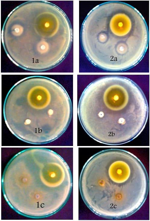 An In Vitro Study on the Effect of some Pre and Probiotics on some pathogenic Bacteria - Image 6