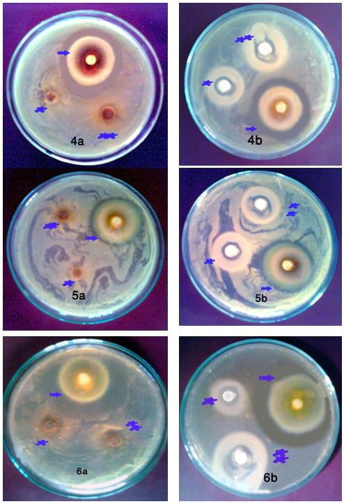 An In Vitro Study on the Effect of some Pre and Probiotics on some pathogenic Bacteria - Image 3