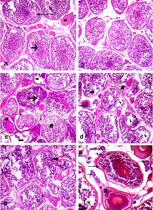 Effect of some Commercial Feed Additives on the Structure of Gonads and Microbiology of Nile Tilapia (Oreochromis Niloticus) Fish - Image 2