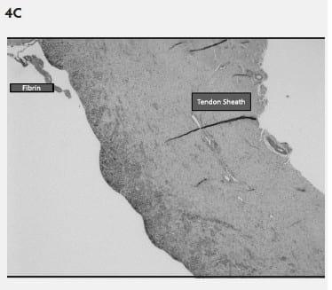 Mycoplasma hyosynoviae A Case Study: Quantitative assessment of incidence and severity across time alongside a diagnostic monitoring plan and intervention - Image 5