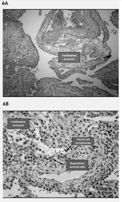 Mycoplasma hyosynoviae A Case Study: Quantitative assessment of incidence and severity across time alongside a diagnostic monitoring plan and intervention - Image 8