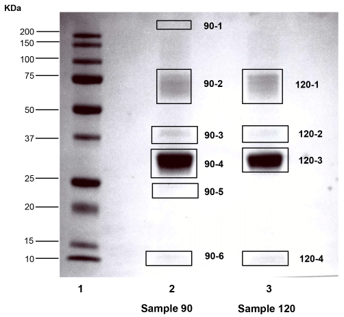 Ovocalyxin-36 Is a Pattern Recognition Protein in Chicken Eggshell Membranes - Image 6