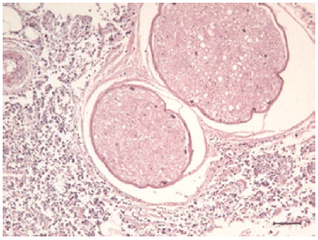 Posterior paralysis in a Holstein cow with Enzootic Bovine Leukosis¤ - Image 5