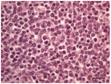 Posterior paralysis in a Holstein cow with Enzootic Bovine Leukosis¤ - Image 4