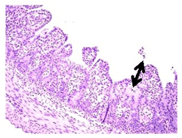 Looking for ways to get relief from PED - Image 4