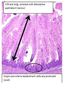 Looking for ways to get relief from PED - Image 3