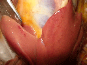 Clinical and Histopathological Investigations on Inclusion Body Hepatitis in Chickens in the Ain Touta Area (Algeria) - Image 1