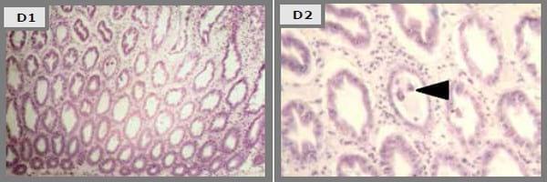 Probiotics reduce mortality and pathology in a standardised AHPND challenge model - Image 7