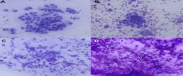 A novel cytologic sampling technique to diagnose subclinical endometritis and comparison of staining methods for endometrial cytology samples in dairy cows - Image 6